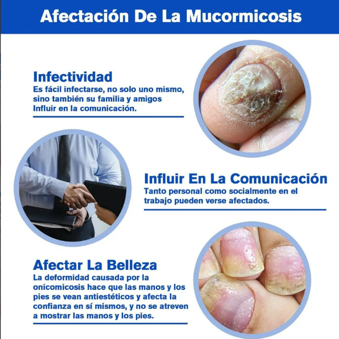 Solución 100% EFECTIVA para los hongos de uñas - 16 parches